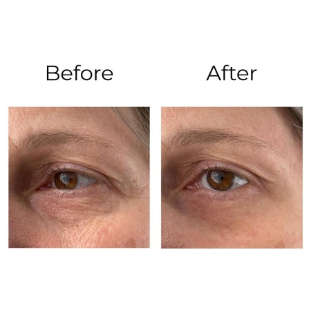 Peptilux – Anti-Falten Augencreme "Shock Action -Effekt" mit LIPHASYN™