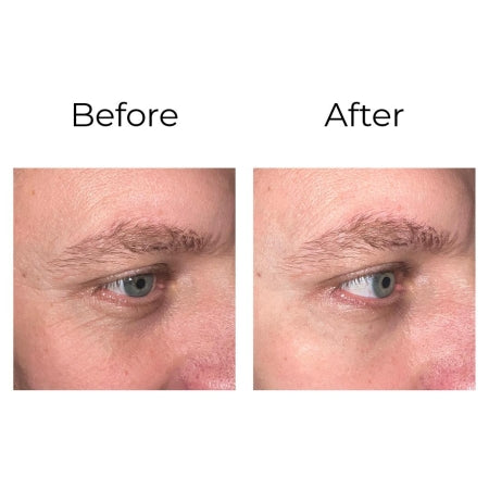 Peptilux – Anti-Falten Augencreme "Shock Action -Effekt" mit LIPHASYN™