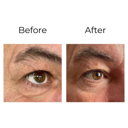 Peptilux – Anti-Falten Augencreme "Shock Action -Effekt" mit LIPHASYN™